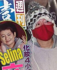 she里的s烧伤照片 第2张 she里的s烧伤照片 第2张