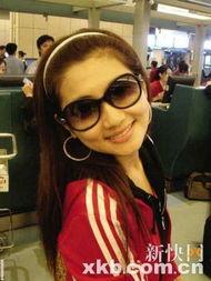 she里的s烧伤照片 第3张 she里的s烧伤照片 第3张